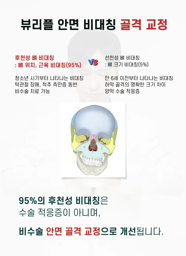 압구정 뷰리플한의원 안면 비대칭 골격 교정