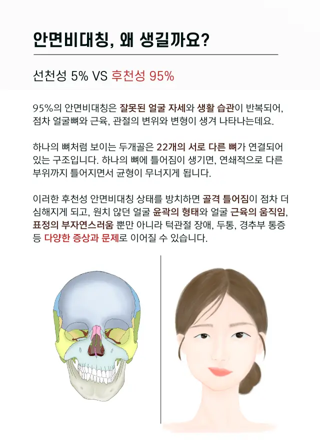 압구정 뷰리플한의원 안면비대칭 생기는 이유