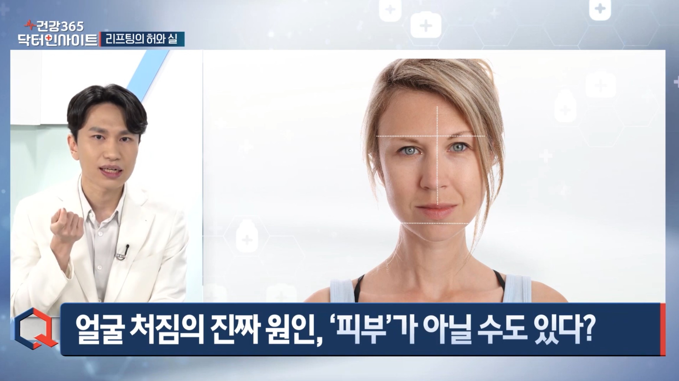 압구정 뷰리플한의원 닥터인사이트 리프팅 1