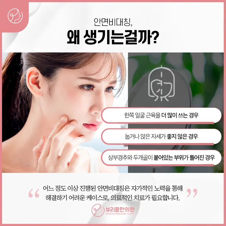 압구정 뷰리플한의원 안면비대칭 원인